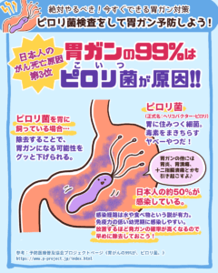 ピロリ菌検査をして胃ガン予防しよう2